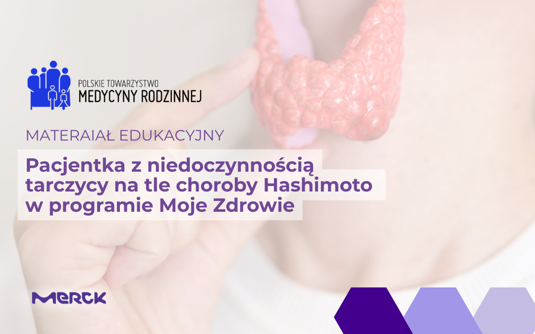 Pacjentka z niedoczynnością tarczycy na tle choroby Hashimoto  w programie Moje Zdrowie